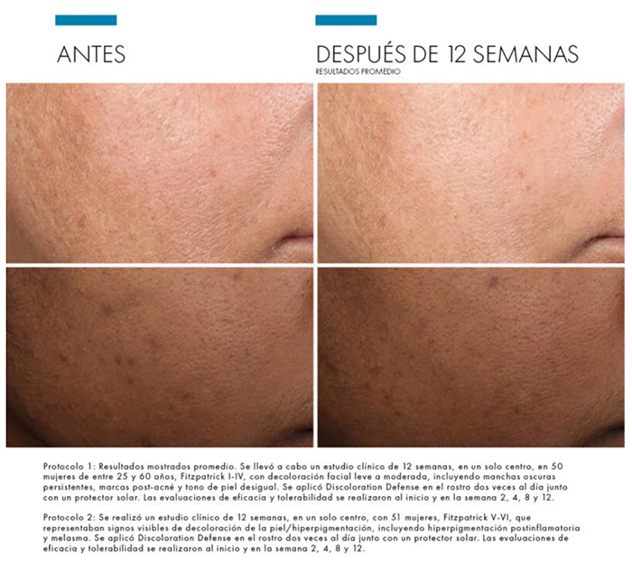 Skin Ceuticals Discoloration Defense 30ml