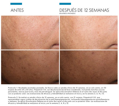 Skin Ceuticals Discoloration Defense 30ml